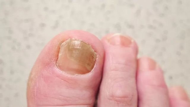 நகங்கள்