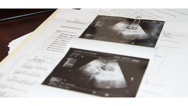 Ultrasound scan