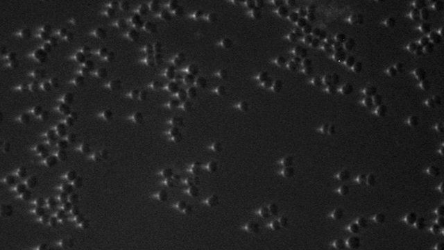 bacteria with light spots on one side