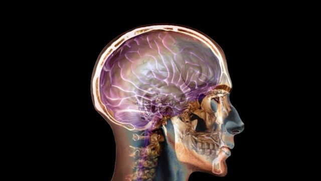 Una imagen de rayos X de una cabeza y el cerebro