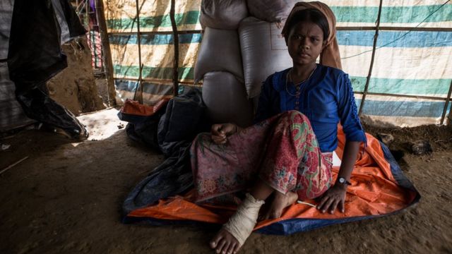 কুতুপালং ক্যাম্পের হাসিনা, ১৬, বলছেন তার পায়ে গুলি লেগেছে।