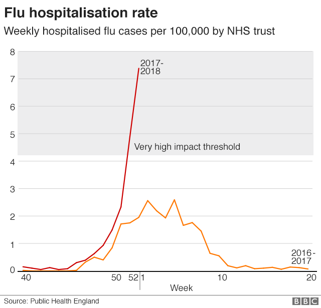 Flu cases Surge in hospital admissions BBC News