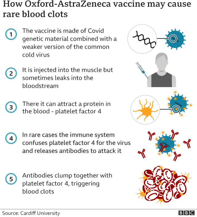 Graphic explaining how blood clots form