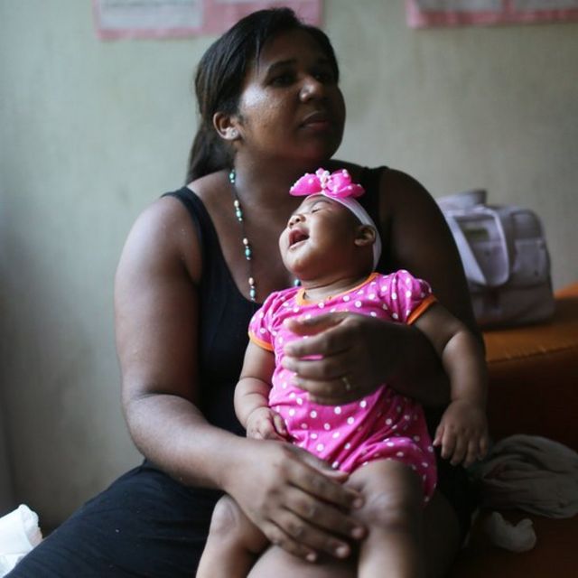 Mãe e filha com microcefalia