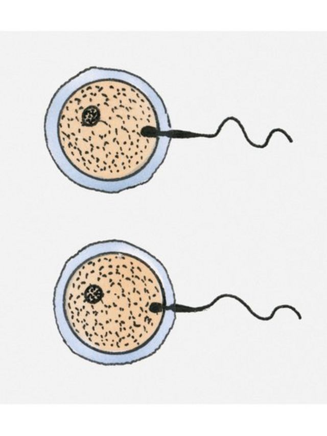 Dos óvulos fecundados