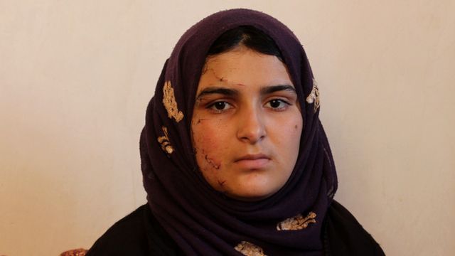 Razia survived the car bomb detonated next to her sign language school