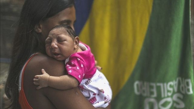 Mãe segura bebê com microcefalia