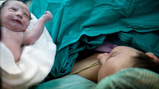 Cesarean section vs natural delivery