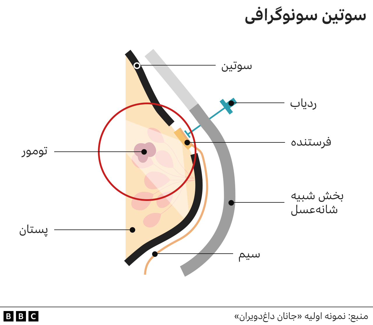 سینه بند