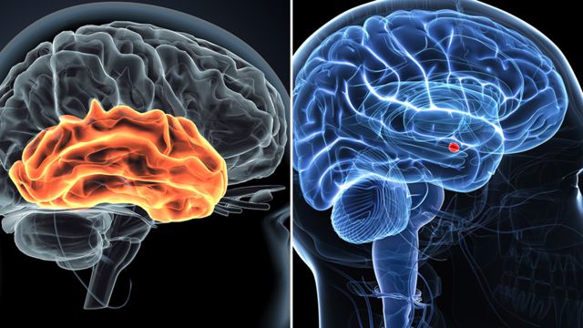 Duas imagens do cérebro. A esquerda ressalta La de la izquierda resalta o córtex auditivo; o da direita destaca a amígdala