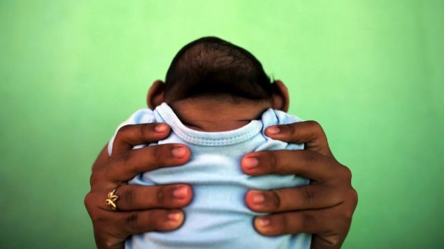 Una madre sostiene a su bebé con microcefalia durante la empidemia de zika en América Latina en 2016