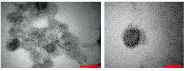 شکل۲: تصویر ویروسی که واکسن برکت براساس آن ساخته شده زیر میکروسکوپ الکترونی، پروتئین‌های شاخکی روی ویروس دیده نمی‌شوند