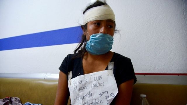 An injured woman in a Chiapas hospital