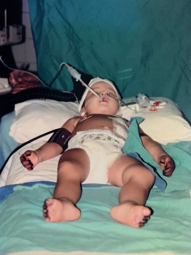Cláudia em coma induzido na infância