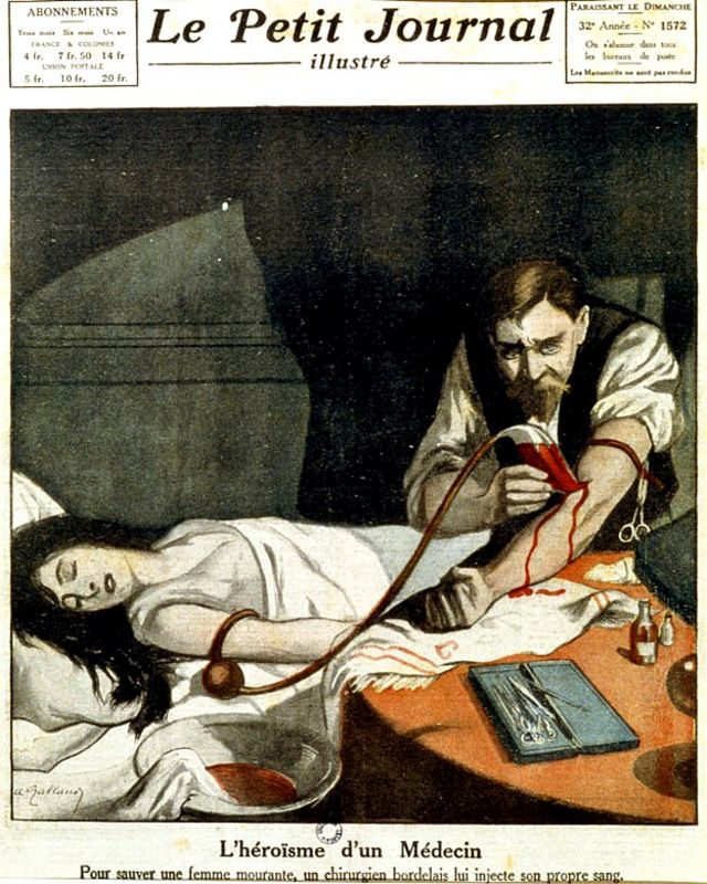Doctor haciéndole una transfusión a una mujer con su propia sangre.