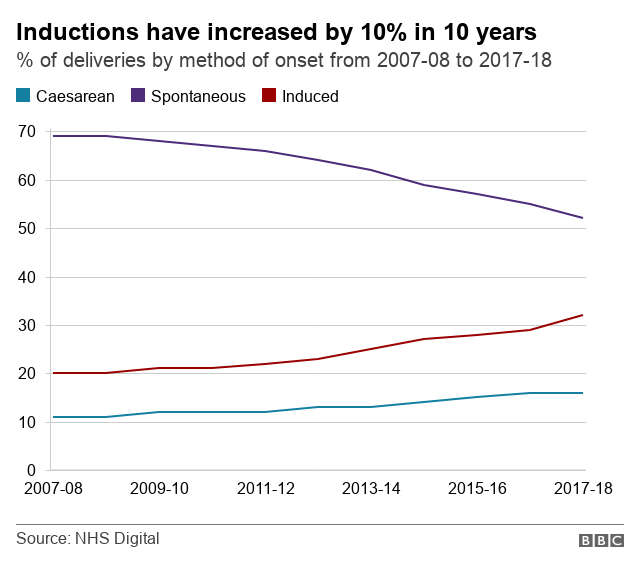 Inductions have risen in England in last 10 years