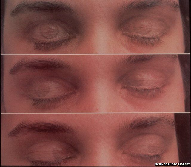 series of images showing eye movement