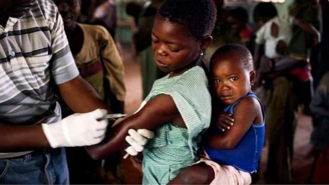 L'épidémie de rougeole en RDC est la plus grande au monde