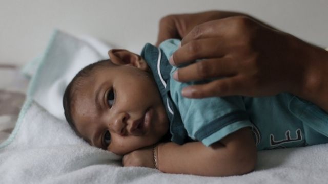 ジカ熱 Who 感染防止の性行為ガイダンスを強化 cニュース