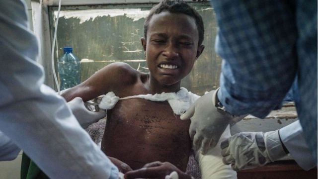 سكان توغوغا المصابون، وهي قرية تبعد حوالي 20 كيلومتراً غرب ميكيلي ، حيث ضربت غارة جوية مزعومة سوقًا تاركة عدداً غير معروف من الضحايا في ميكيلي ، عاصمة منطقة تيغراي ، إثيوبيا ، في 23 يونيو ، 2021.
