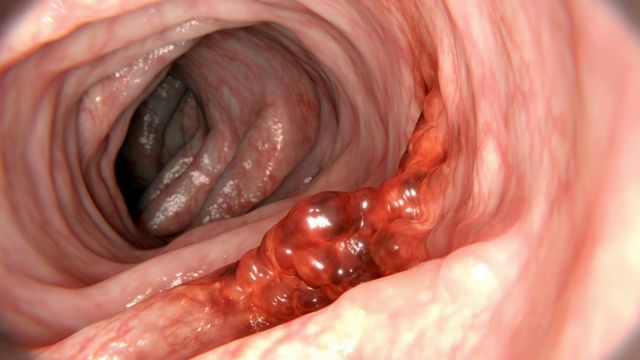 மலக்குடல்