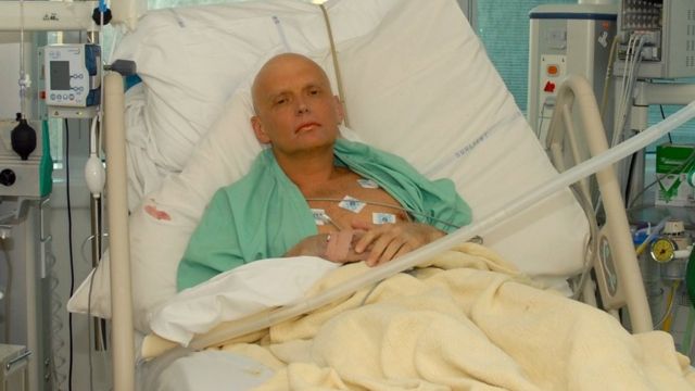 Александр Литвиненко после отравления
