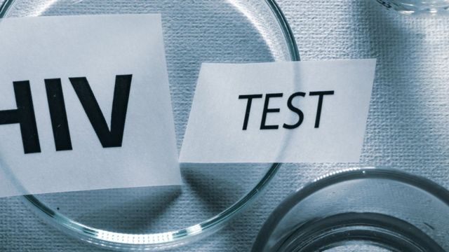 இலங்கை எச்ஐவி