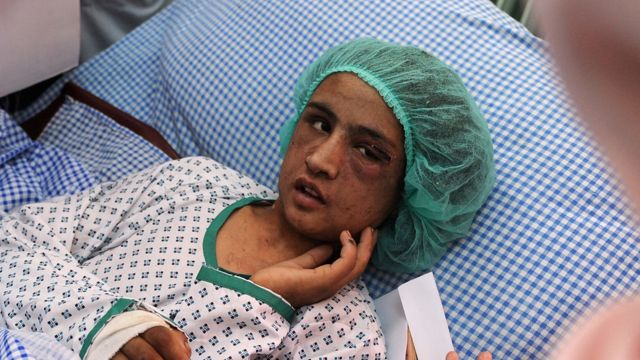 Sahar Gul, adolescente, en una cama en el hospital