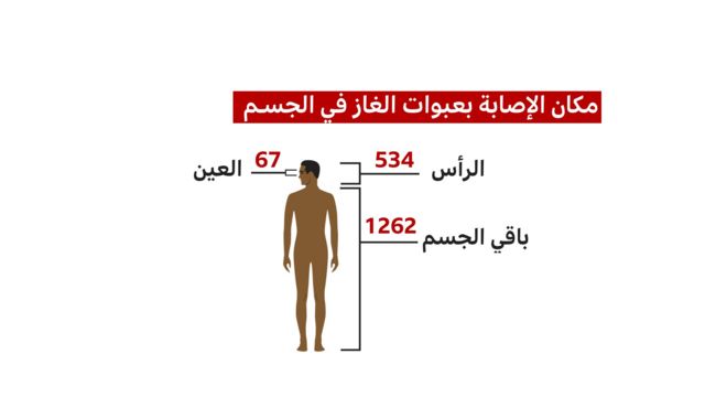 رسم يوضح أماكن الإصابة بعبوات الغاز في أجساد المتظاهرين وعدد حالات الإصابة