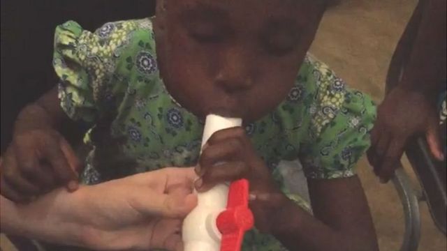 malaria breath test