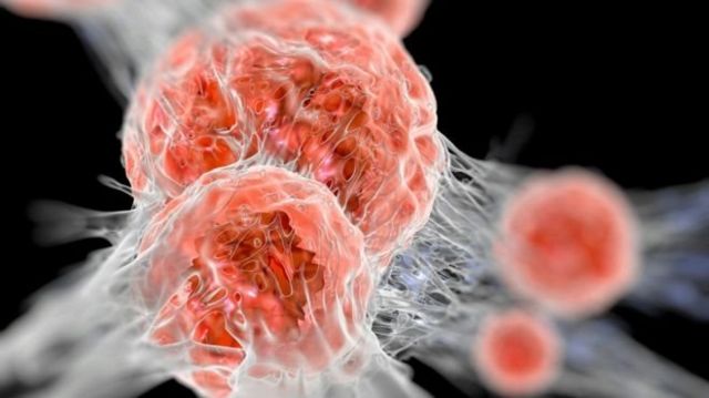 Рак, який лікують імунотерапією: огляд можливостей