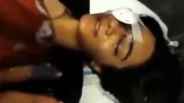 غزال ترفع علامة النصر من سريرها في المستشفى