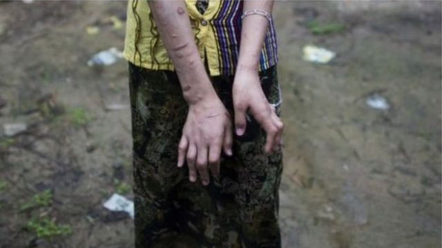 အမျိုးသမီး