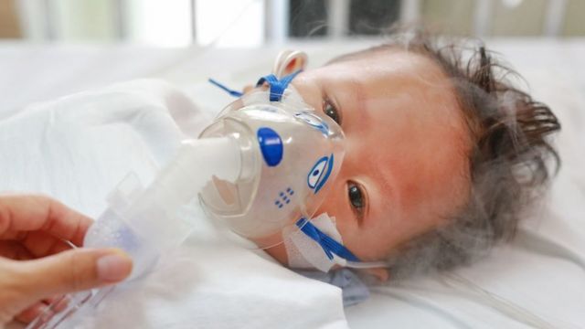 Niño pequeño con máscara de oxígeno