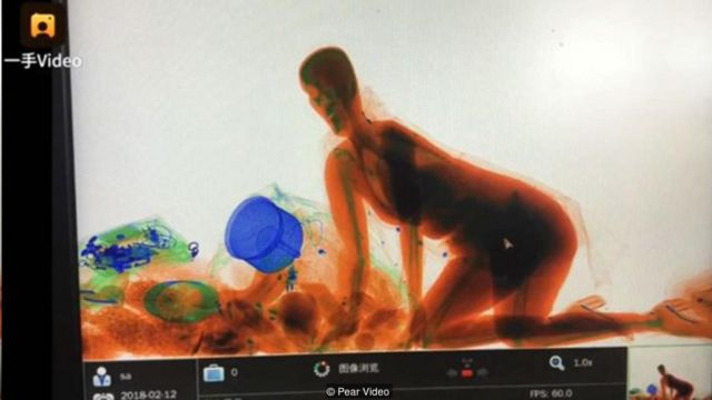 Women and X-Ray