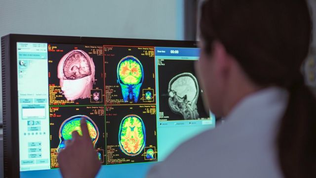 Female doctor looking at MRI scanner monitor showing a human brain