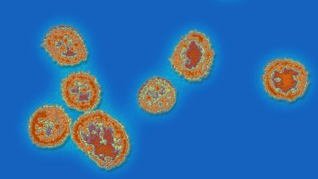 Vírus da febre de Lassa