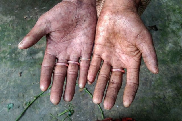 අමල් සර්කර් ගේ දෑත
