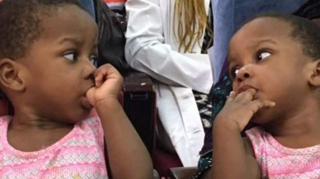 Des Medecins Nigerians Separent Des Siamoises c News Afrique