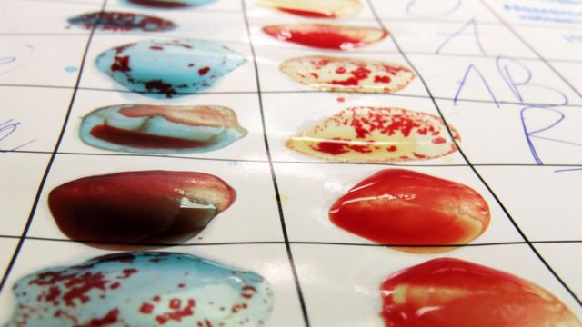 Folha com anotações de tipos sanguíneos (A, O, AB...) ao lado de gotas de sangue