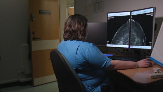 تقوم أخصائية الأشعة بمراجعة صور الثدي الشعاعية في مستوصف أبردين الملكي