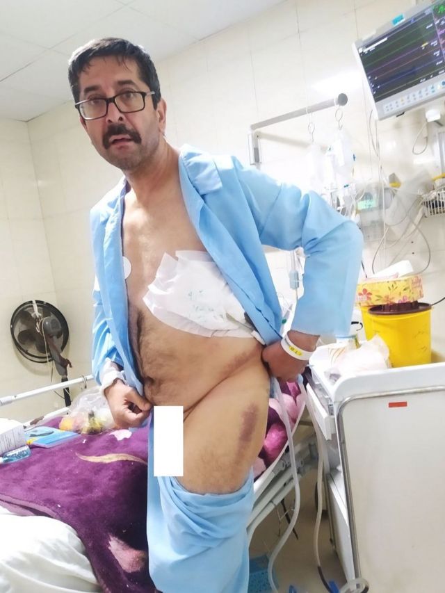 عکسی که به همین شکل به دست بی‌بی‌سی فارسی رسیده و حمید قره‌حسنلو در آن دیده می‌شود