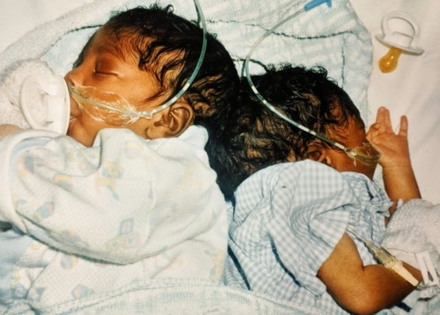 Sanchia and Eman shortly after they were born