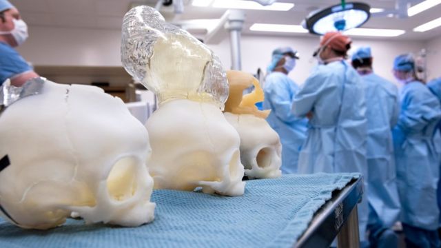 La operación fue todo un éxito, le dijo a BBC Muno el doctor Proctor, neurocirujano jefe del Hospital Infantil de Boston, en Estados Unidos.