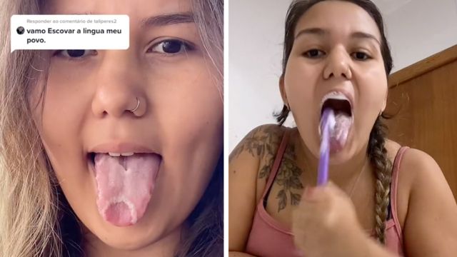Colagem de fotos mostra jovem mostrando a língua e depoisescovando