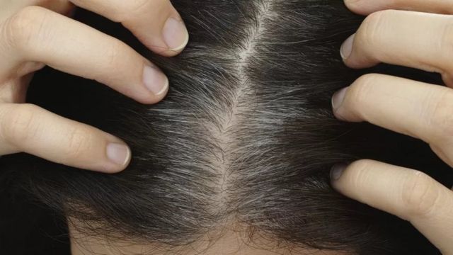 தலைமுடி