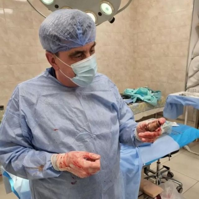 الجراح أندري فيربا يمسك بالعبوة في يده.