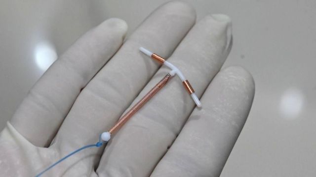 Un médico sostiene un dispositivo anticonceptivo DIU para colocarlo en el útero de una paciente