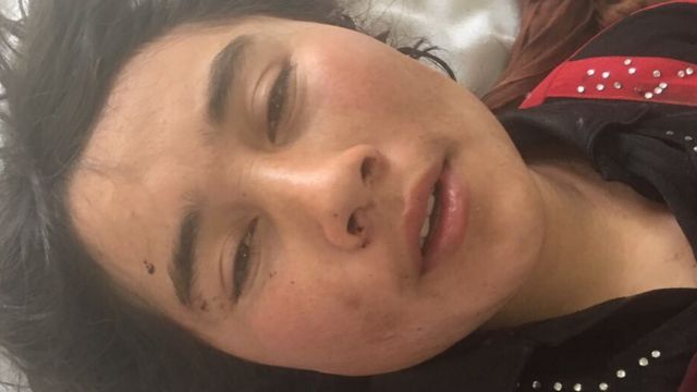 Zarina se recupera en un hospital de Afganistán