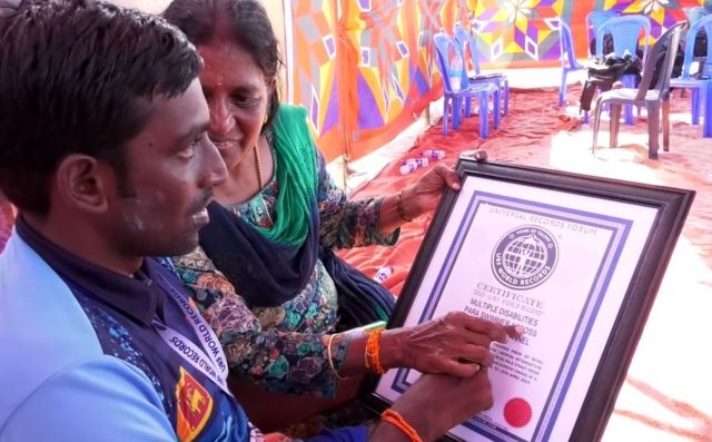 செரிப்ரல் பால்சி